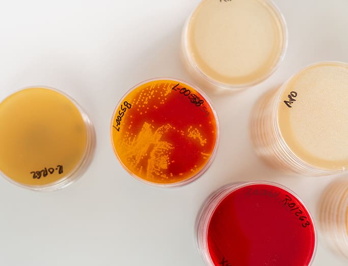 Cultivo - Laboratorios Brolab